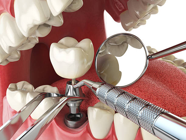 Best Emergency Dental Care for Trauma or Injury in Southern Pines, NC
